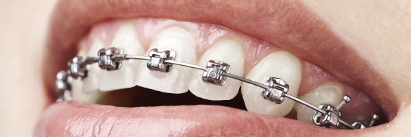 orthodontie.png