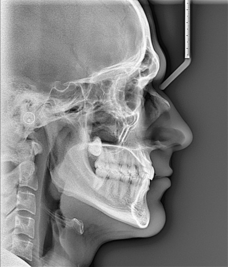 Figure 4- site Rx CUMD.png